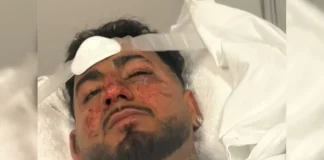 “इंडियन निकल जा!” ऑस्ट्रेलिया में नस्लभेदी हमले का शिकार भारतीय छात्र, देखिए VIDEO