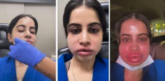 Urfi Javed का ब्यूटी एक्सपेरिमेंट बना मुसीबत, VIDEO देखकर आप भी सहम जाएंगे