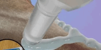 3 मिनट में हड्डी जोड़ देगा चीन का नया Bone Glue, अब नहीं पड़ेगी स्टील रॉड-स्क्रू की जरूरत