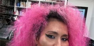 क्या आप जानते हैं दुनिया की सबसे बड़े गाल वाली लड़की… क्यों हुई ट्रोल ?