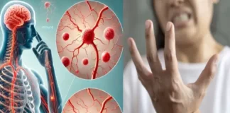 गुइलेन-बैरे सिंड्रोम से 7वीं मौत, 167 नए केस, 48 ICU और 21 वेंटिलेटर पर, जानें अबतक का पूरा अपडेट